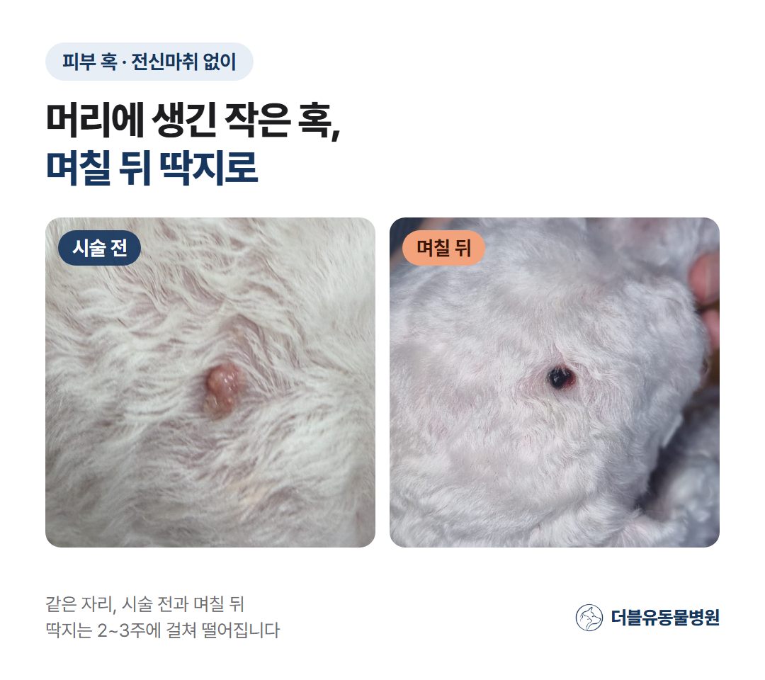 혹 제거 뒤 딱지가 생기고 아무는 과정